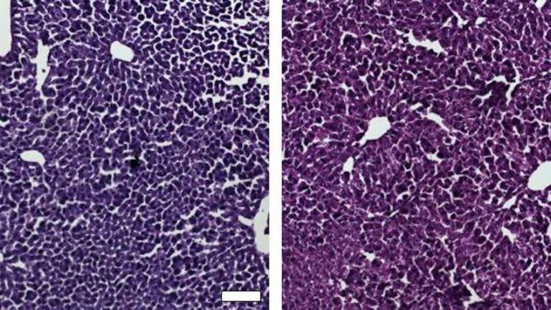 Histological sections of liver from control mice treated with saline (left) and the CRISPR/Cas9 epigenetic repression system in which cholesterol levels were lowered (right) show generally normal and healthy tissue. 